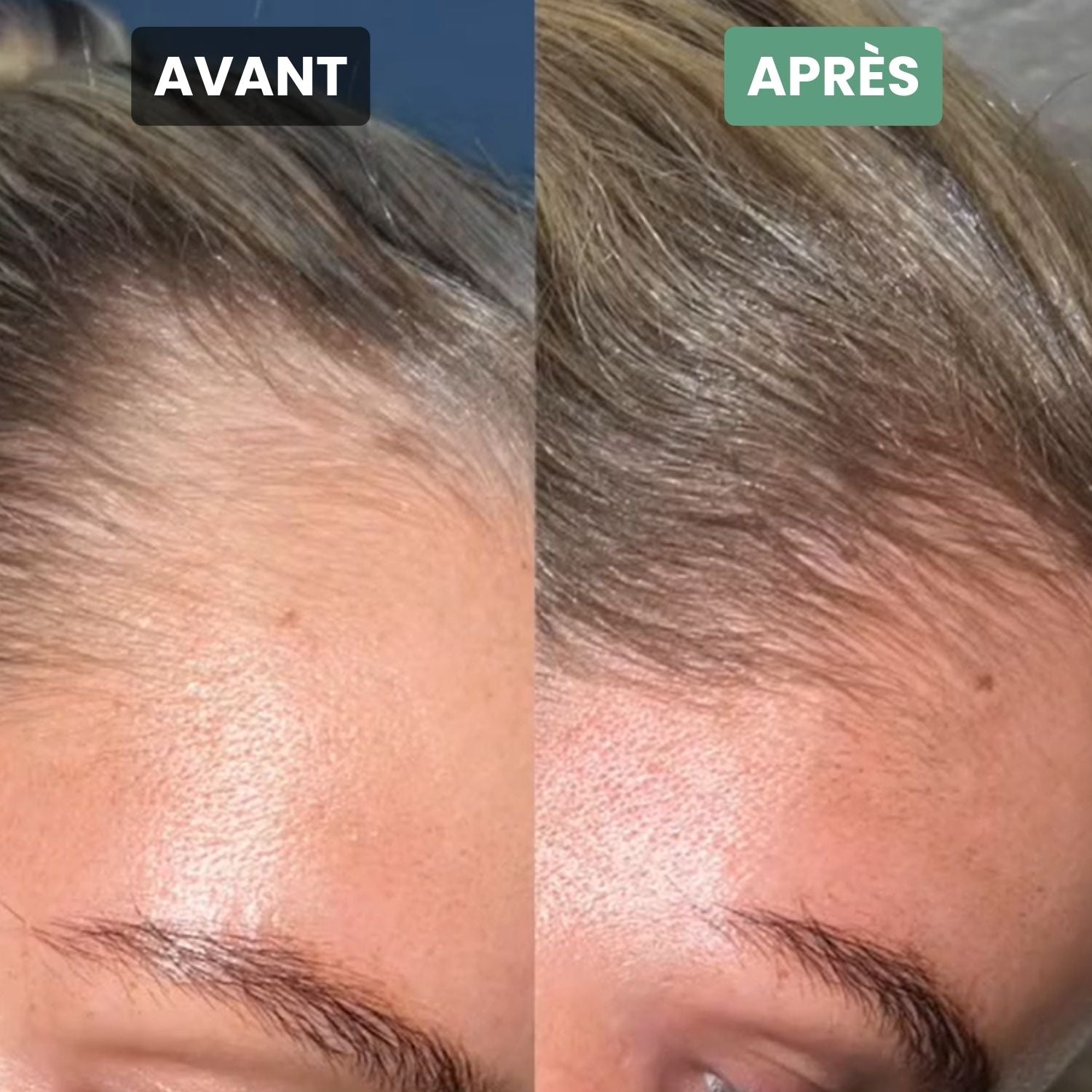 Sublime Hair Vitamins